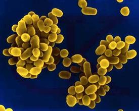 布鲁氏菌病重疫的省份将纳入强制免疫范围