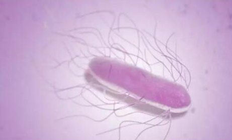 世界卫生组织关于沙门氏菌（非伤寒）的描述